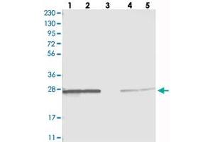 Western blot analysis of Lane 1: RT-4, Lane 2: U-251 MG, Lane 3: Human Plasma, Lane 4: Liver, Lane 5: Tonsil with PMM1 polyclonal antibody . (PMM1 Antikörper)