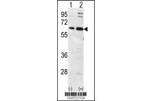 Western blot analysis of Ubiquilin1 using Ubiquilin1 Antibody using 293 cell lysates (2 ug/lane) either nontransfected (Lane 1) or transiently transfected with the Ubiquilin1 gene (Lane 2). (Ubiquilin 1 Antikörper  (N-Term))