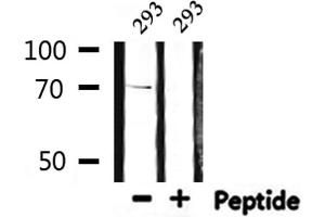 Western blot analysis of extracts from 293, using S6K Antibody. (RPS6KB1 Antikörper  (C-Term))