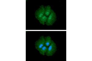 ICC/IF analysis of CTGF in Hep3B cells.