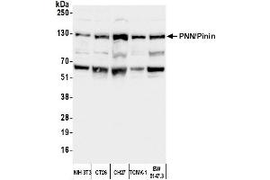 anti-Pinin, Desmosome Associated Protein (PNN) (C-Term) antibody