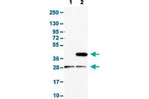 Western Blot analysis with CD1E polyclonal antibody . (CD1e Antikörper  (AA 79-147))
