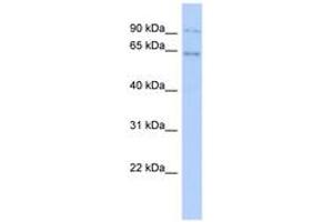 ZNF319 Antikörper  (AA 35-84)