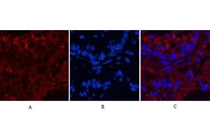 Immunofluorescence analysis of rat lung tissue. (CD4 Antikörper)