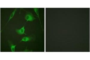 Immunofluorescence analysis of HeLa cells, using Keratin 8 (Ab-431) Antibody. (KRT8 Antikörper  (AA 401-450))