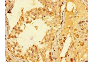 Immunohistochemistry of paraffin-embedded human testis tissue using ABIN7176667 at dilution of 1:100 (ELAC1 Antikörper  (AA 1-363))
