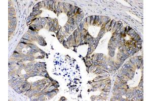 Immunohistochemistry (IHC) image for anti-Ribosomal Protein S6 (RPS6) (AA 13-52), (N-Term) antibody (ABIN5518869)