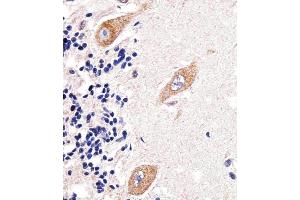 Immunohistochemical analysis of paraffin-embedded H. (PAPD4 Antikörper  (N-Term))