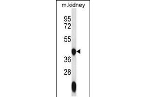 Western blot analysis in mouse kidney tissue lysates (35ug/lane). (GTPBP10 Antikörper  (C-Term))