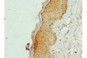 Immunohistochemistry of paraffin-embedded human skin tissue using ABIN7148255 at dilution of 1:100 (COL9A3 Antikörper  (AA 445-684))