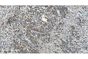 IHC analysis of NOX2/gp91phox/CYBB using anti-NOX2/gp91phox/CYBB antibody (ABIN7599875). (CYBB Antikörper  (AA 124-559))