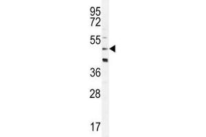 CRFR2D antibody western blot analysis in HeLa lysate (CRFR2D Antikörper)