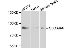 Western blot analysis of extracts of various cell lines, using SLC39A6 antibody.