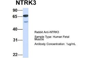 Host:  Rabbit  Target Name:  NTRK3  Sample Type:  Human Fetal Muscle  Antibody Dilution:  1. (NTRK3 Antikörper  (C-Term))