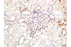 Formalin-fixed and paraffin embedded rat kidney labeled with Rabbit Anti-NFKBIA/IKB alpha Polyclonal Antibody, Unconjugated (ABIN674454) at 1:200 followed by conjugation to the secondary antibody and DAB staining (NFKBIA Antikörper  (AA 1-120))