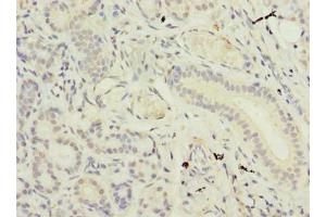 Immunohistochemistry of paraffin-embedded human pancreatic tissue using ABIN7171032 at dilution of 1:100 (SUSD4 Antikörper  (AA 56-290))