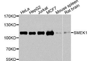 Western blot analysis of extracts of various cells, using SMEK1 antibody. (SMEK1 Antikörper)