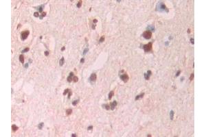 Immunohistochemistry (IHC) image for anti-Amyloid beta 1-42 (Abeta 1-42) antibody (ABIN7427870)