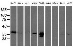 Image no. 2 for anti-Microtubule-Associated Protein, RP/EB Family, Member 2 (MAPRE2) antibody (ABIN1499320) (MAPRE2 Antikörper)