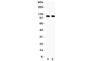 Western Blotting (WB) image for anti-Nuclear Factor of kappa Light Polypeptide Gene Enhancer in B-Cells 1 (NFKB1) (N-Term) antibody (ABIN3032042)