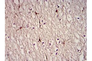 Immunohistochemical analysis of paraffin-embedded brain tissues using GFAP mouse mAb with DAB staining (GFAP Antikörper)