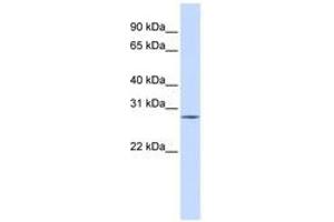 Image no. 1 for anti-Spleen Focus Forming Virus (SFFV) Proviral Integration Oncogene Spi1 (SPI1) (C-Term) antibody (ABIN6740536) (SPI1 Antikörper  (C-Term))