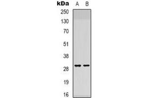Western blot analysis of ATP5F1 expression in K562 (A), NIH3T3 (B) whole cell lysates. (ATP5F1 Antikörper)