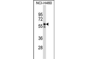KRT6B Antibody (Center) (ABIN657654 and ABIN2846649) western blot analysis in NCI- cell line lysates (35 μg/lane). (Keratin 6B Antikörper  (AA 207-236))
