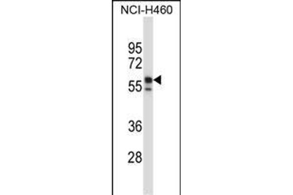Keratin 6B Antikörper  (AA 207-236)