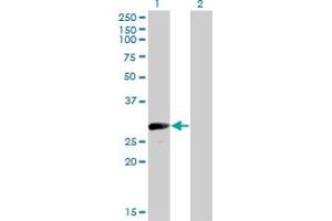 Western Blot analysis of VGLL1 expression in transfected 293T cell line by VGLL1 monoclonal antibody (M01), clone 3C7.