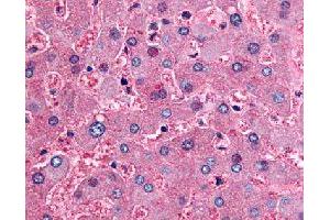 Immunohistochemical (Formalin/PFA-fixed paraffin-embedded sections) staining in human liver with DPP9 polyclonal antibody . (DPP9 Antikörper)
