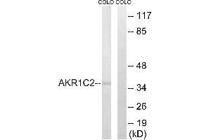 Western blot analysis of extracts from COLO cells, using AKR1C2 antibody. (AKR1C2 Antikörper)