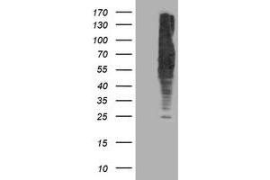 HEK293T cells were transfected with the pCMV6-ENTRY control (Left lane) or pCMV6-ENTRY DLD (Right lane) cDNA for 48 hrs and lysed. (DLD Antikörper)