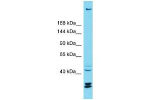 Host: Rabbit Target Name: KIAA1551 Sample Type: ACHN Whole cell lysates Antibody Dilution: 1.