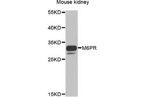 Western blot analysis of extracts of mouse kidney, using M6PR antibody.