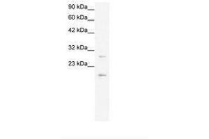 Image no. 2 for anti-Claudin 1 (CLDN1) (C-Term) antibody (ABIN6735811)