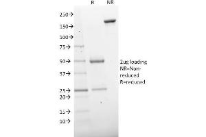 SDS-PAGE Analysis Purified CD73 Mouse Monoclonal Antibody (NT5E/2503). (CD73 Antikörper)