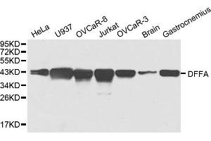 Western blot analysis of extracts of various cell lines, using DFFA antibody. (DFFA Antikörper)