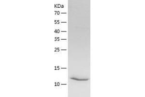 Intelectin 2 (ITLN2) (AA 39-175) protein (His tag)