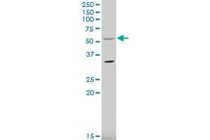 RCBTB2 polyclonal antibody (A01), Lot # 060109JC01 Western Blot analysis of RCBTB2 expression in HeLa . (RCBTB2 Antikörper  (AA 86-194))