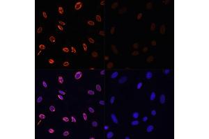 Immunofluorescence analysis of NIH/3T3 cells using Acetyl-Histone H3-K36 antibody (ABIN7267671) at dilution of 1:100. (Histone 3 Antikörper  (H3K36))