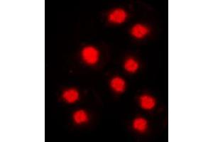 Immunofluorescent analysis of Cyclin A1 staining in MCF7 cells. (Cyclin A1 Antikörper  (C-Term))