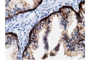 Immunohistochemical staining of paraffin-embedded Human colon tissue using anti-CRYM mouse monoclonal antibody. (CRYM Antikörper)