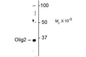 Image no. 1 for anti-Oligodendrocyte Lineage Transcription Factor 2 (OLIG2) antibody (ABIN372693) (OLIG2 Antikörper)