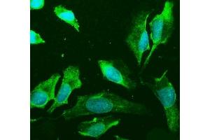 IF analysis of PLD2 using anti-PLD2 antibody (ABIN7601520). (Phospholipase D2 Antikörper  (AA 37-924))