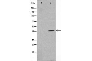 Western blot analysis on HuvEc cell lysate using TNFSF11 Antibody. (RANKL Antikörper  (Internal Region))