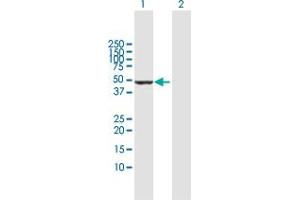 Western Blotting (WB) image for anti-Villin 1 (VIL1) (AA 1-421) antibody (ABIN521332)
