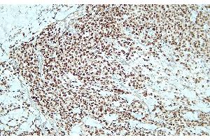 Immunohistochemistry (IHC) image for anti-SRY (Sex Determining Region Y)-Box 10 (SOX10) (C-Term) antibody (ABIN7598799) (SOX10 Antikörper  (C-Term))