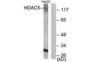 Western blot analysis of extracts from HepG2 cells, using HDAC5 (Ab-259) Antibody. (HDAC5 Antikörper  (AA 225-274))
