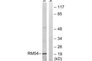 Western blot analysis of extracts from Jurkat cells, using MRPL54 antibody. (MRPL54 Antikörper  (Internal Region))